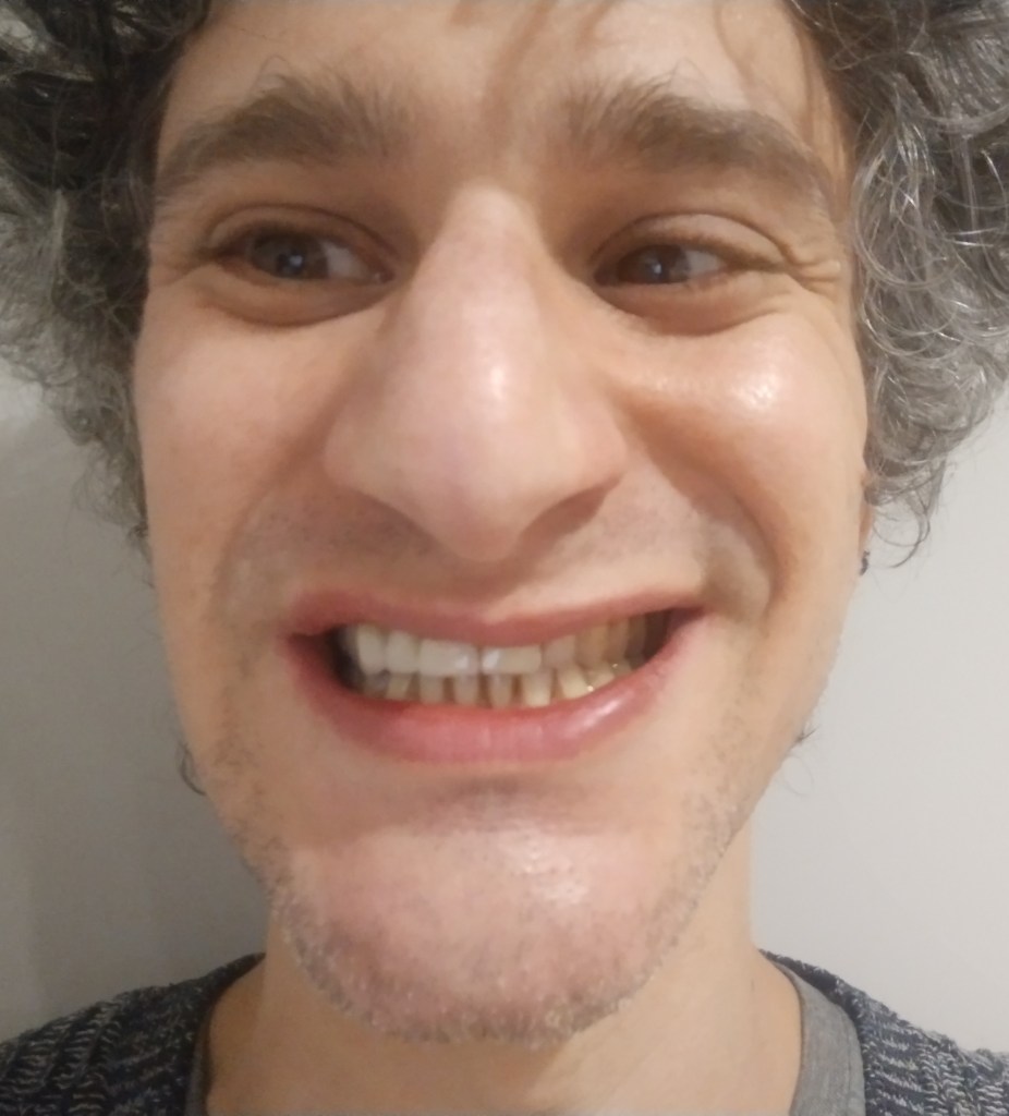 Teeth with a bridge in 2023